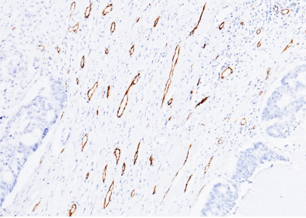 Recombinant CD31/PECAM1 Monoclonal Antibody (AN300304P)