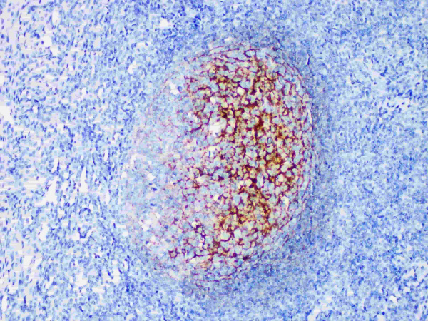 CD35 Monoclonal Antibody (ELAB6279-M)