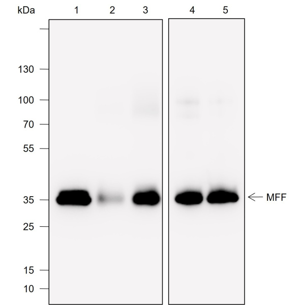 Recombinant MFF Monoclonal Antibody (AN301995L)