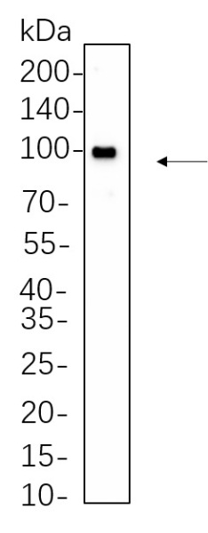Recombinant EGR1 Monoclonal Antibody (AN301338L)