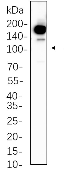 Recombinant Phospho-Met (Tyr1234/1235) Monoclonal Antibody (AN301333L)