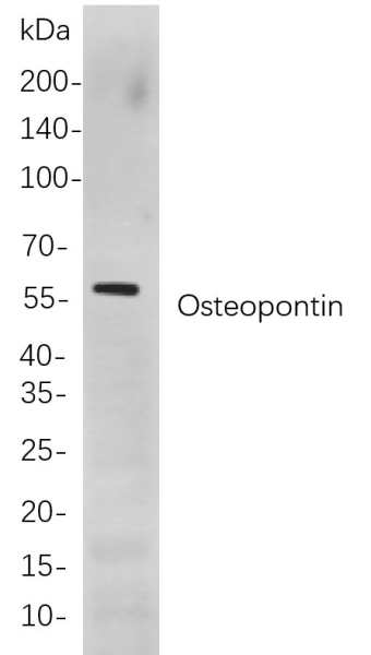 Recombinant Osteopontin Monoclonal Antibody (AN300896L)