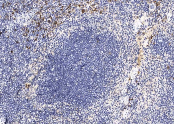 IL12B Monoclonal Antibody (AN200248P)
