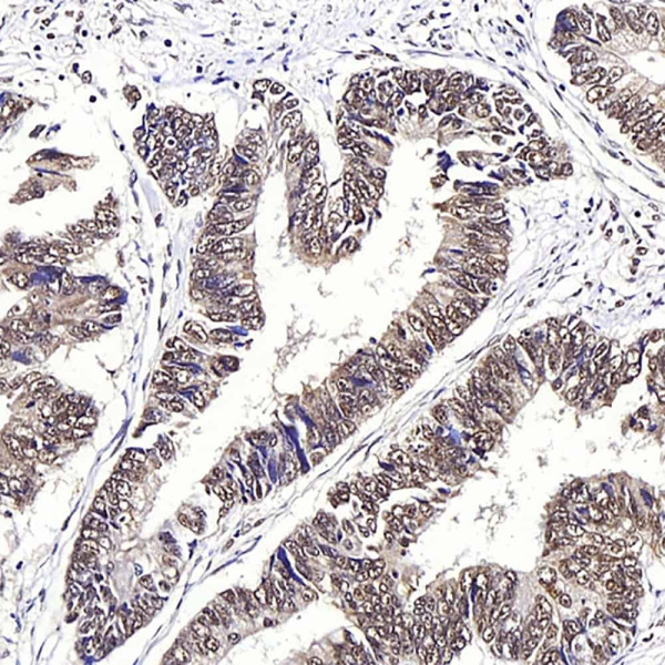 JMJD6 Polyclonal Antibody (E-AB-70209)