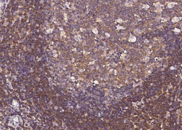 ERN1/IRE1 Monoclonal Antibody (AN200216P)