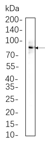 Recombinant Phospho-STAT3 (Tyr705) Monoclonal Antibody (AN300638L)