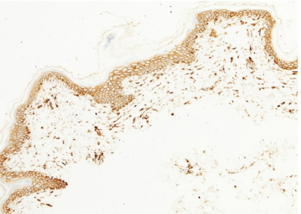 CD44 Monoclonal Antibody (AN200020P)