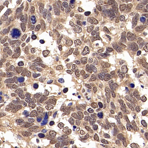 JUN Polyclonal Antibody (E-AB-70029)