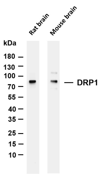 Recombinant DRP1 Monoclonal Antibody (AN301080L)