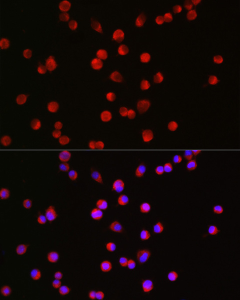 BSN Polyclonal Antibody (E-AB-92249)