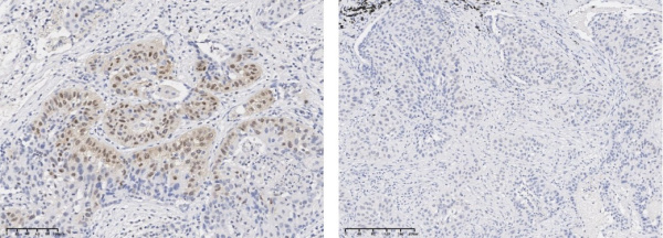 Recombinant Phospho-AKT (Ser473) Monoclonal Antibody (AN300086L)