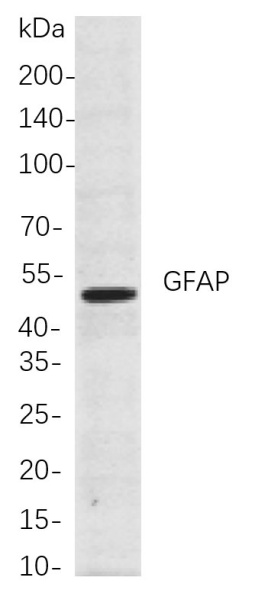 Recombinant GFAP Monoclonal Antibody (AN300975L)