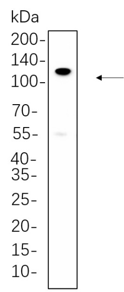 Recombinant PI3-Kinase p110 β Monoclonal Antibody (AN300619L)