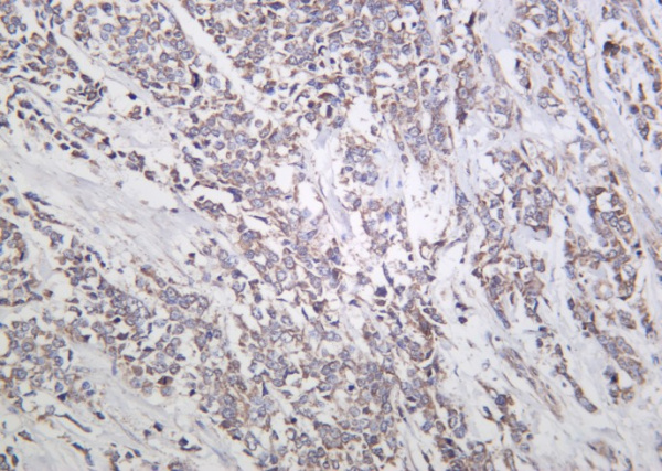 Recombinant Actinin-α1 Monoclonal Antibody (AN301292L)