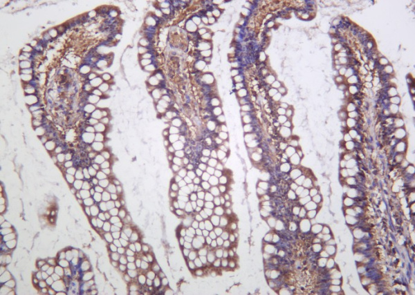 Recombinant Cystathionase Monoclonal Antibody (AN301253L)