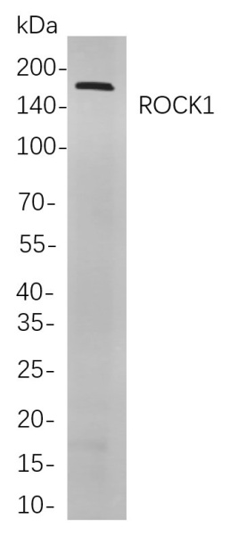 Recombinant ROCK1 Monoclonal Antibody (AN301001L)