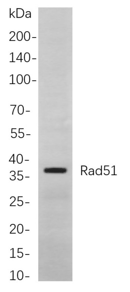 Recombinant Rad51 Monoclonal Antibody (AN300932L)