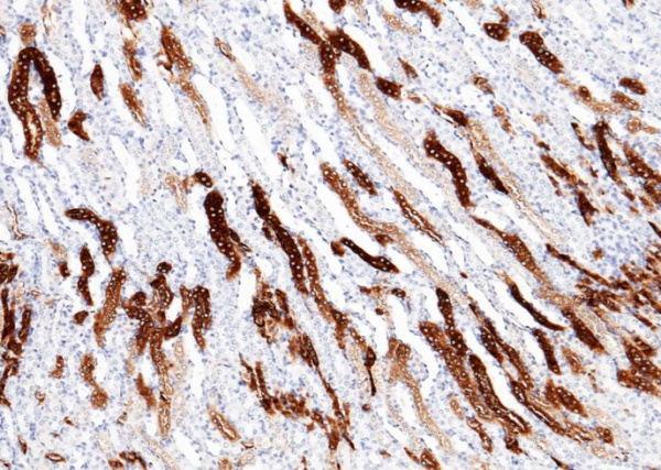 Recombinant MEP1A Monoclonal Antibody (AN300467P)