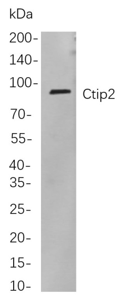 Recombinant Ctip2 Monoclonal Antibody (AN301052L)