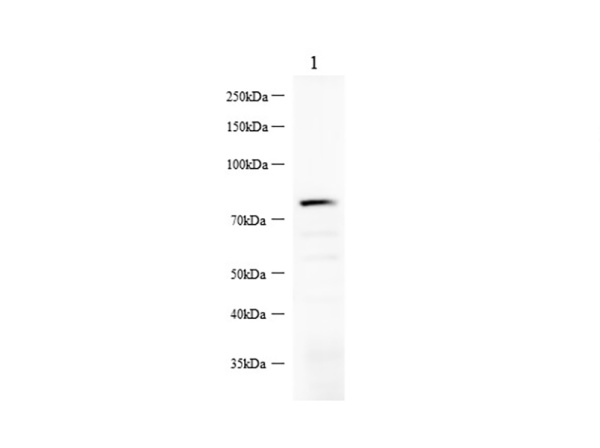 Nectin-4/NECTIN4 Polyclonal Antibody (AN006920L)