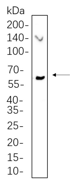 Recombinant Phospho-Chk2 (Thr68) Monoclonal Antibody (AN300595L)