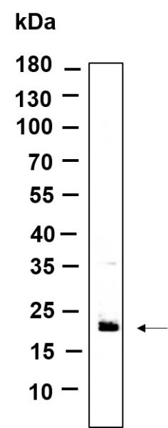 Recombinant RAB7B Monoclonal Antibody (AN301219L)