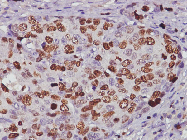 Ki67 Monoclonal Antibody (AN005400L)