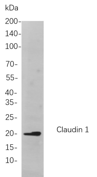 Recombinant Claudin 1 Monoclonal Antibody (AN300979L)
