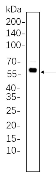 Recombinant Phospho-Akt (Thr308) Monoclonal Antibody (AN301330L)