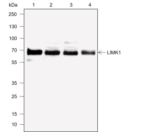 Recombinant LIMK1 Monoclonal Antibody (AN302042L)