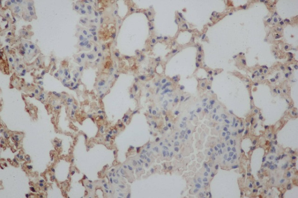 Aβ40 Polyclonal Antibody (E-AB-40070)