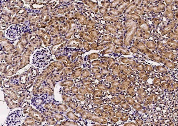 Recombinant GFRA1 Monoclonal Antibody (AN300488P)
