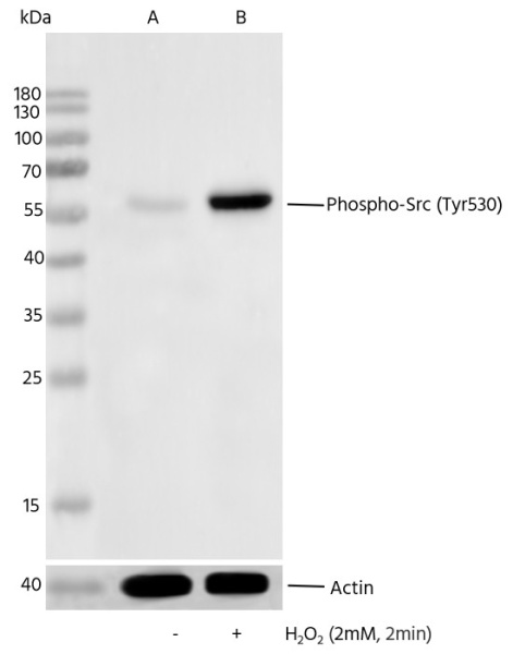 Recombinant Phospho-Src (Tyr530) Monoclonal Antibody (AN300386L)