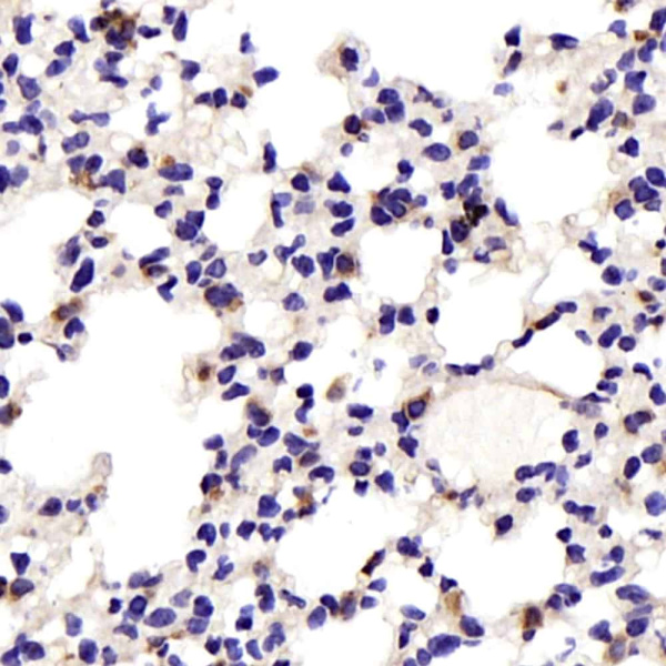 JNK1/2/3 Polyclonal Antibody (E-AB-70345)