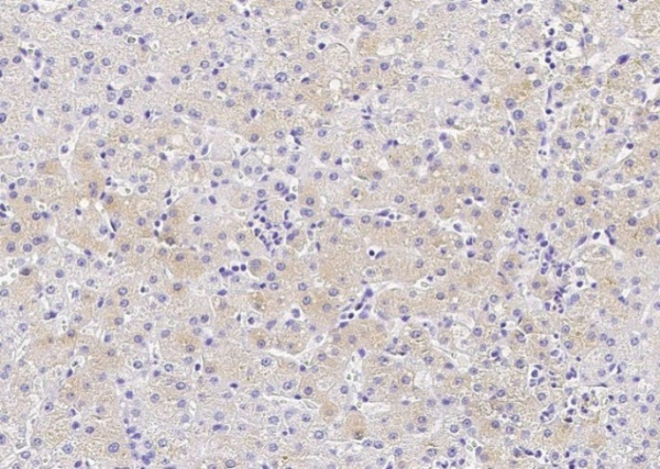 Recombinant CES3/Carboxylesterase 3 Monoclonal Antibody (AN300221P)