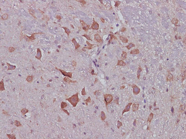 CNTF Polyclonal Antibody (AN006040L)