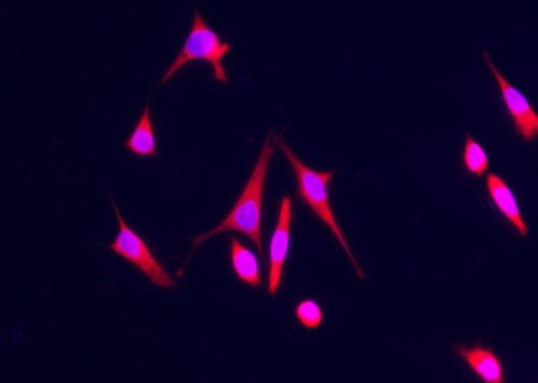 Recombinant S100A7 Monoclonal Antibody (AN300382P)