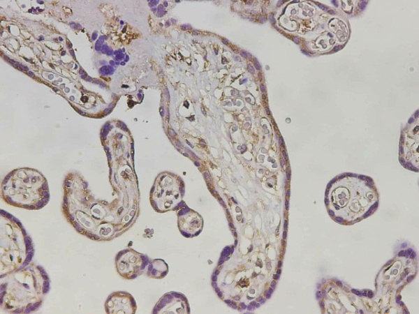 MHCG Polyclonal Antibody (E-AB-40663)