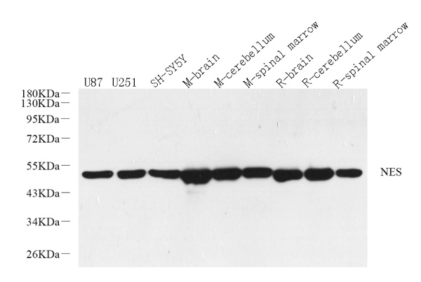 ENO2 Polyclonal Antibody (E-AB-70256)