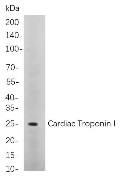 Recombinant Cardiac Troponin I Monoclonal Antibody (AN300892L)