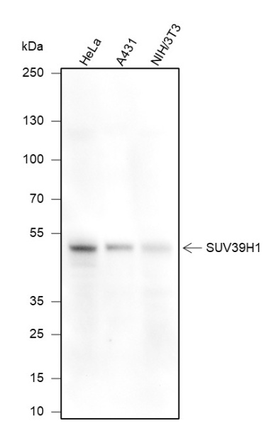 Recombinant SUV39H1 Monoclonal Antibody (AN301669L)