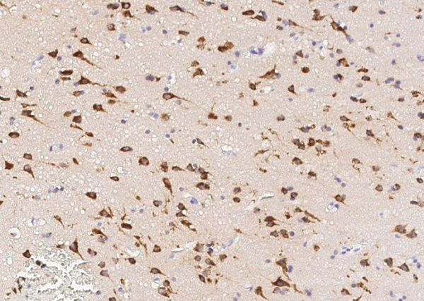 Neuroserpin/SerpinI1 Monoclonal Antibody (AN200205P)