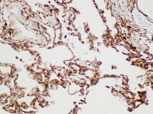 S100A4 Polyclonal Antibody (E-AB-40459)