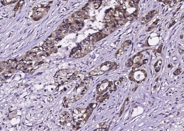 EGFR/HER1/ErbB1 Monoclonal Antibody (AN200001P)