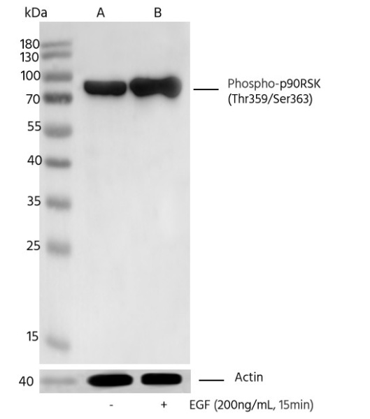 Recombinant Phospho-p90RSK (Thr359, Ser363) Monoclonal Antibody (AN300156L)