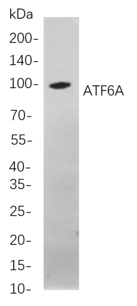 Recombinant ATF6A Monoclonal Antibody (AN301093L)