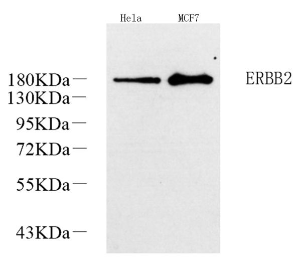 ERBB2 Polyclonal Antibody (E-AB-70195)