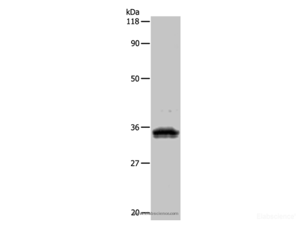 UPK3B Polyclonal Antibody (E-AB-10013)