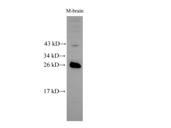 RAB5B Polyclonal Antibody (E-AB-40198)