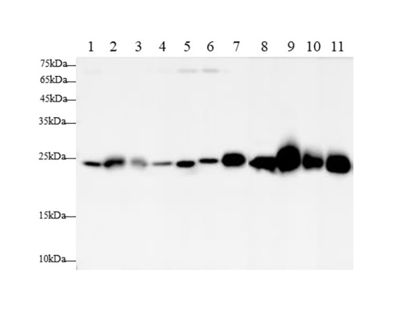 SOD2 Polyclonal Antibody (AN006910L)